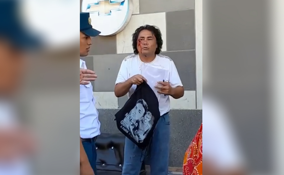 В Ургенче задержали мужчину с шизофренией, который пытался украсть девочку. Видео В Ургенче задержали мужчину с шизофренией, который пытался украсть девочку. Видео