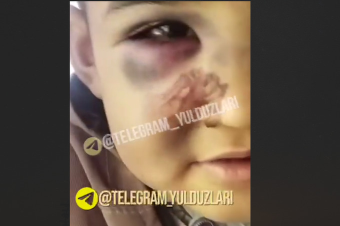 Детский омбудсман взяла под контроль ситуацию с избиением ребёнка в Самарканде