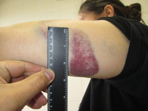 In Light of Photos, Kyrgyz Authorities Claim Detained Journalist Staged Her Own Bruises