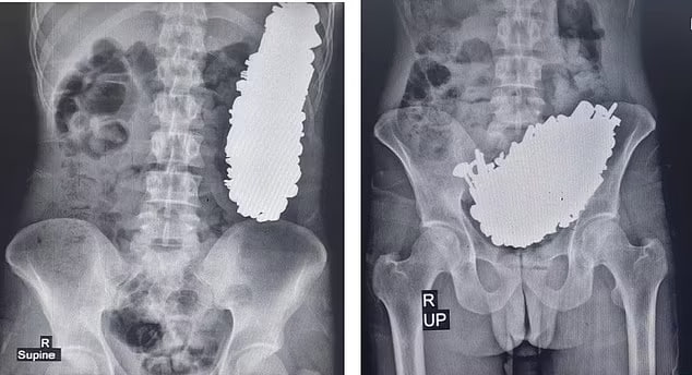 Фото Journal of Medical Case Reports