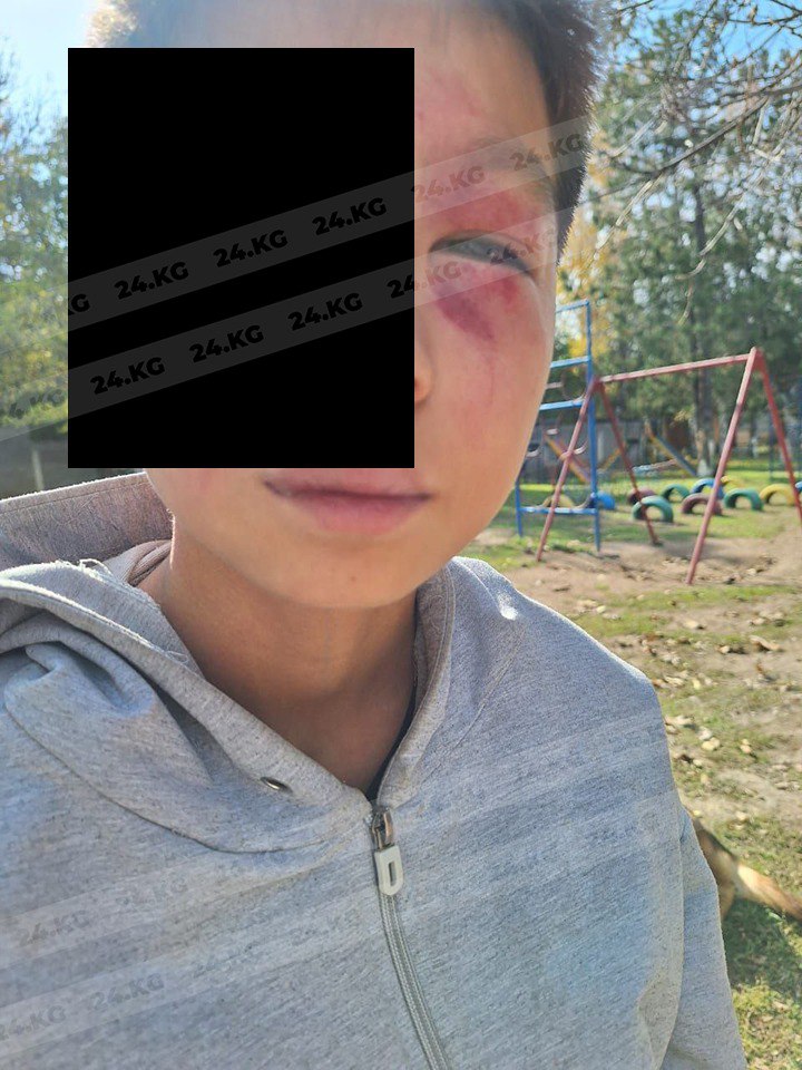 В Кеминском районе муж директора детского дома побил воспитанника учреждения