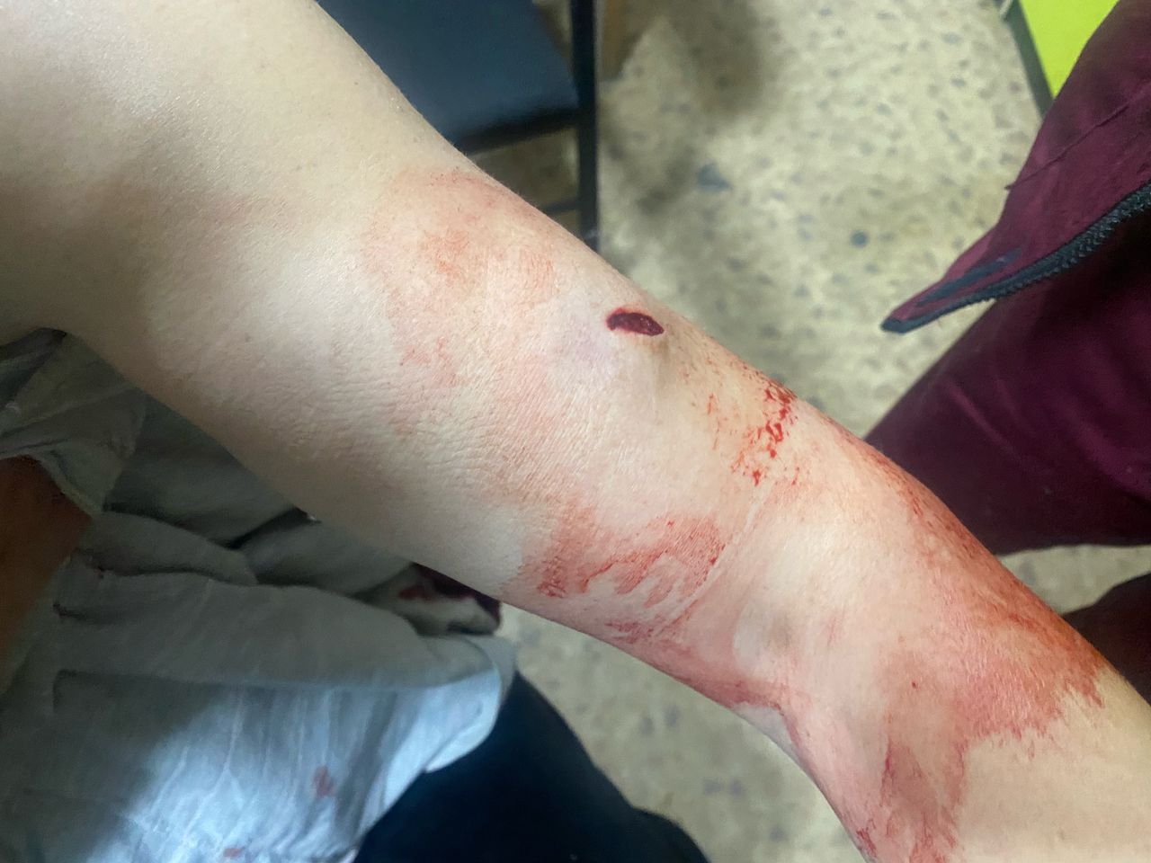 В Бишкеке женщина обвинила мужа в том, что он несколько раз ударил ее ножом
